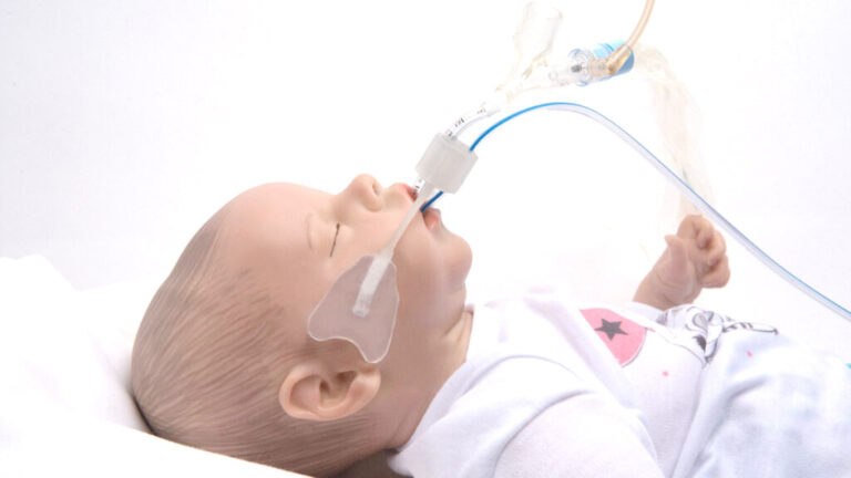 Arcangel Neonatal Pediatric Endotracheal Tube Warriornp